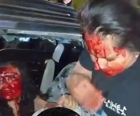 Two woman injured in road accident happened in bogota 