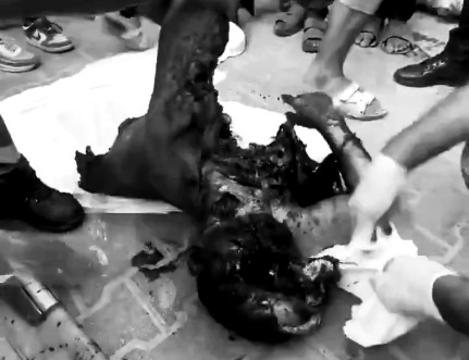 A half Shattred body of Palestinian after Israeli Air strike 