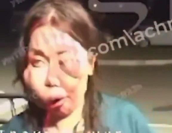 Russian woman asking for HELP after being punished by abusive husband 