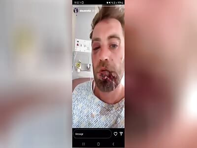 Aftermath Of Scottish Knife Fight