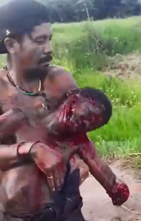 Teenager Found Mutilated by a Machete