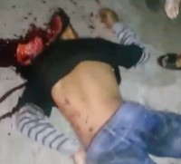 He's Got A Splitting Headache