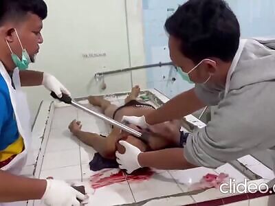 Axe Buried In His Head