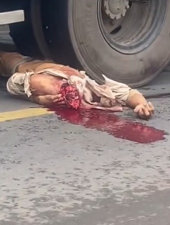 Decapitated in accident