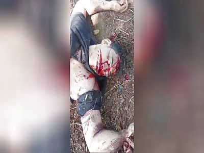 Accident Victim Agonizes