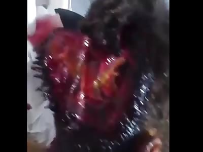 victim of airstrike attack 