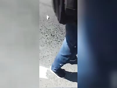 Dude's Leg Ripped Off