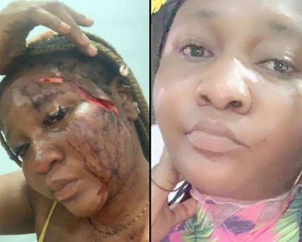 Angry GF Stabs a Lady for Sleeping with her Boyfriend