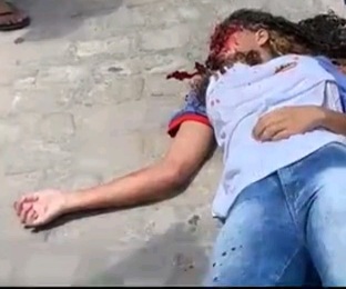 Students girls fight end with slashed face 