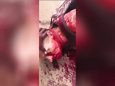 Dude Bleeding Out..........