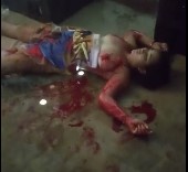 Woman Stabbed In Her Tits By Ex Boyfriend