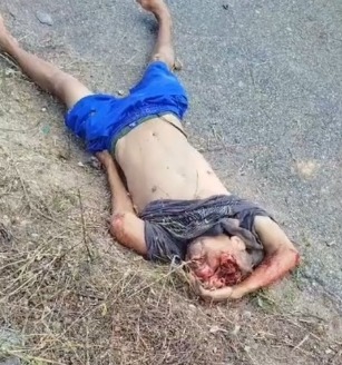 the man had his skull broken in an accident