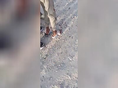 Blew His Hand Off With Fireworks