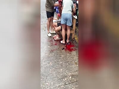 Hand Blown Off With Fireworks