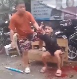 Another Angle Showing Teen's Hand Blown Off With Fireworks