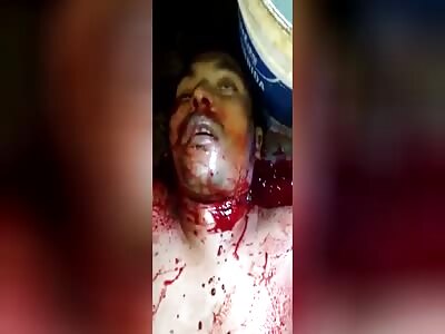 Cut In His Throat & Breathing His Last
