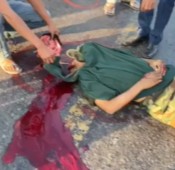 Dude's Head Split In Two