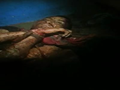 In a Venezuelan Jail: A prisoner is forced to eat their own fingers