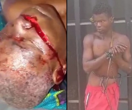 Drug user attack his own father with machete 