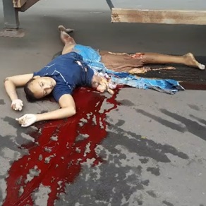  Woman Riding A Motorcycle With Her Sister Died Under The Wheels Of A Trailer