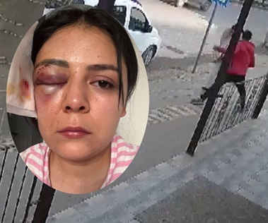 Bastard Punched a Woman Walking Down the Street for No Reason In Turkey