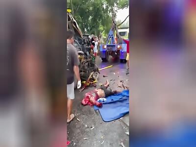 Damn! A Traffic accident left a dudes face destoryed