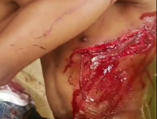 Viking member victim of the BLACK AXE GANG attack 