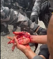 Football Fan had his Hand Blown off by a Rocket