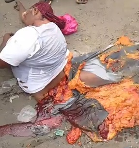 Extremely Graphic Video Shows a Woman Ripped in Half on the Street 