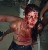 Murderous Bloodbath: Woman Was Slashed With Machete