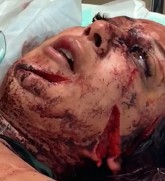 Woman Hacked Up By Bf For Cheating