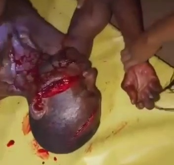 Victime of machete attack transported to hospital 