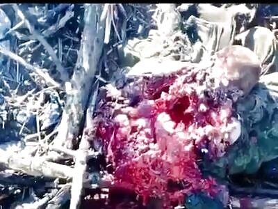 Russian gets struck by a drone exposing his vital organs.