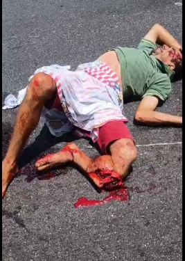 victim has terrible leg injury