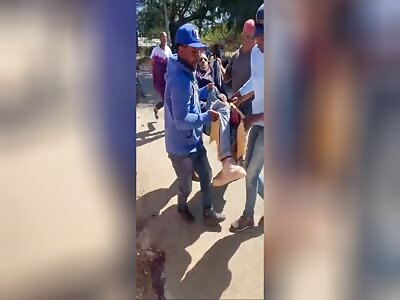 Biker With Fucked Up Leg