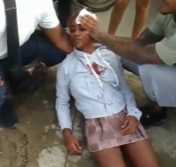 Female Bikers Colide Each Other