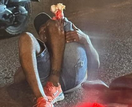 Biker's Bone Exposed