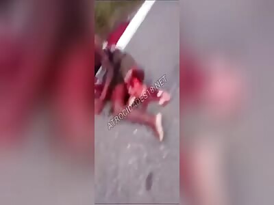 BRAZILIAN 'CSA' PLAYER HAS HIS LEG BLOWN OFF AFTER ACCIDENT ON AL-101 