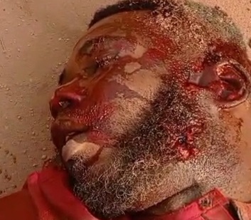 Viking member butchered by the BLACK AXE GANG 