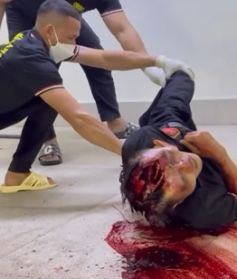 Man Died After Falling From the 13th Floor of Ba Ria Hospital in Vietnam