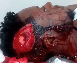  Shaking Dude With Extra Hole In His Head