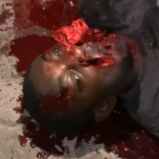 DAMN: Man Shot in the Mouth Agonizes in Horrific Pain