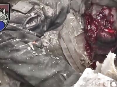 disfigured soldier dying