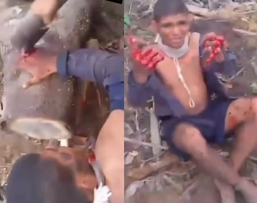 A Man's Fingers Are Chopped Off With An Axe As A Warning To All Robbers