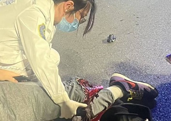 Chinese man riding motorcycle lost his leg after collision with car 