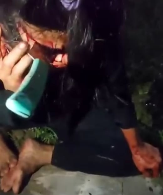 Brutal Robbery Leaves Woman With Knife Stuck in Her Eye