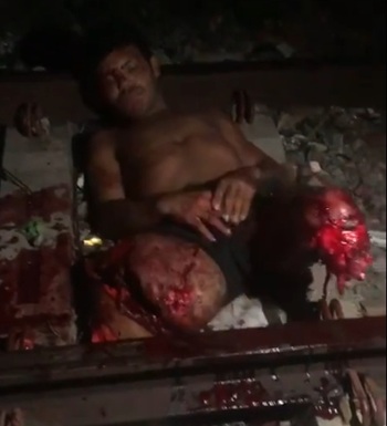 Poor Man Looking What Train Did To Him In Shock.