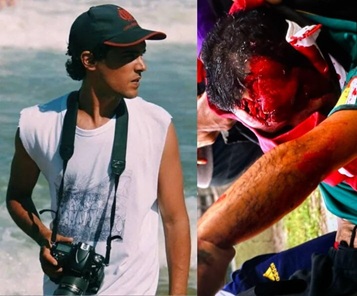 Journalist In Critical Condition After Violent Anti-Milei Protest