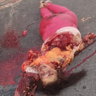 Brutal Carnage From Horrific Bus Accident...Woman Totally Mangled.