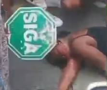 Strange First Aid For Head Crushed Woman